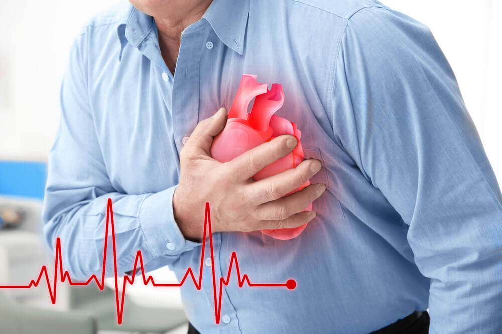 heart-attack
