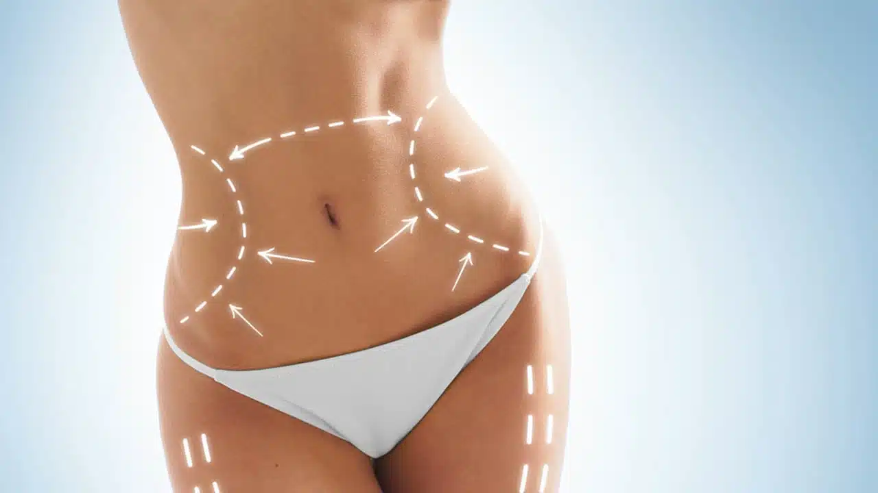 abdominoplastia malaga clinica renova