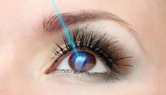 laser-eye-surgery