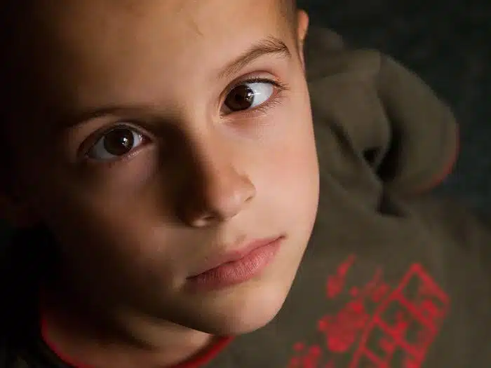 kosoglazie-prichini-simptomi-diagnostika-i-lechenie_4