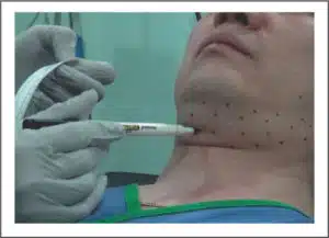 apratim-goeal-300x217