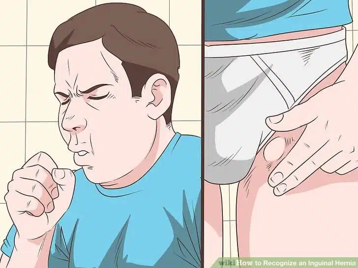 aid432060-v4-728px-recognize-a-scrotal-hernia-step-1-version-4