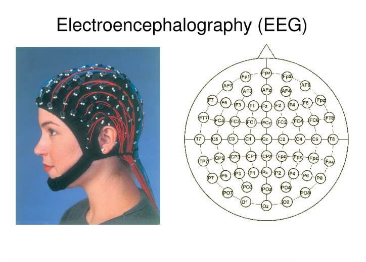 electroencephalography-eeg-22