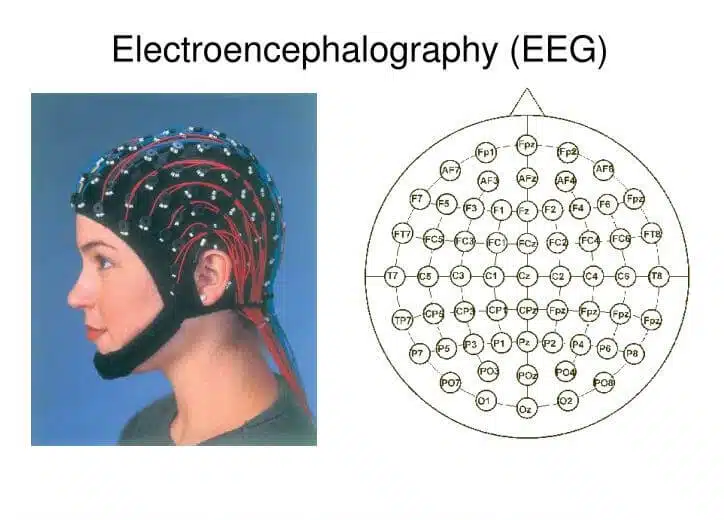 electroencephalography-eeg-22