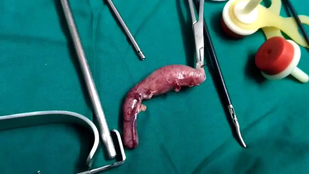 maxresdefault-2-1024x576