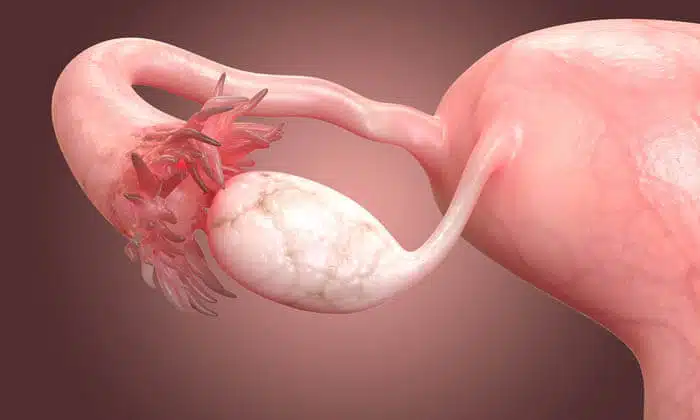 497e3b0e00000578-0-image-a-7_15193336199582