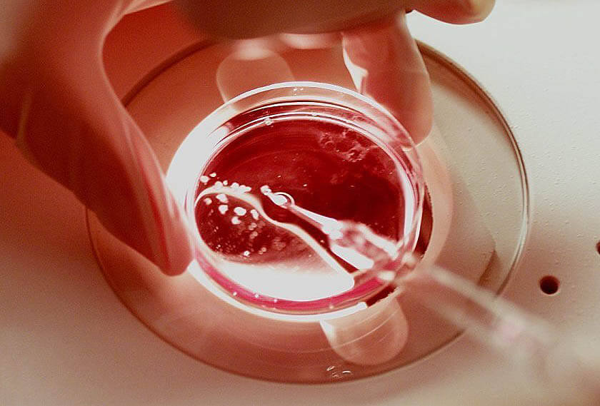 egg-donation-2