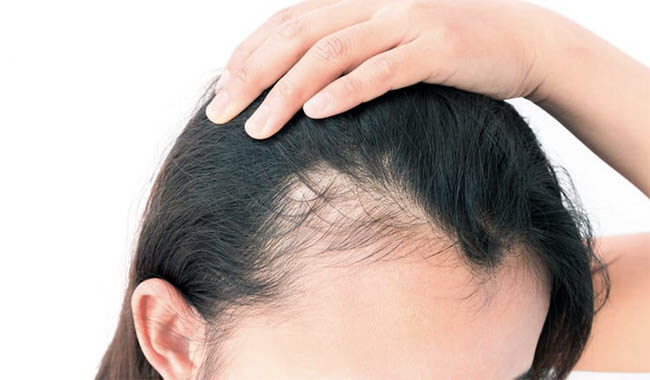 best-hair-transplant-clinic-in-turkey-istanbul
