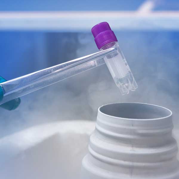 egg-freezing