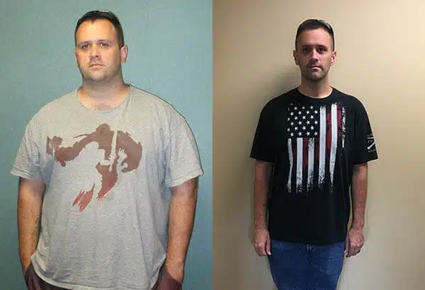 anthony-hockensmith-before-and-after-gastric-bypass-surgery