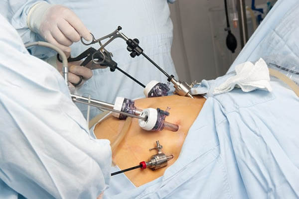 gastricbypasssurgeryg50862_1358078-860x573-1