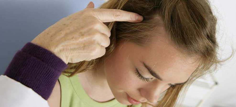 how-to-control-hair-loss-02