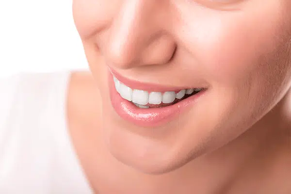 14001006-grant-park-snap-on-smile-low-quality
