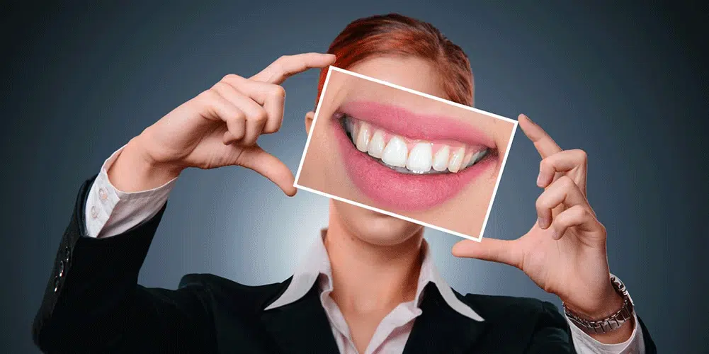 14001008 hollywood smile for web