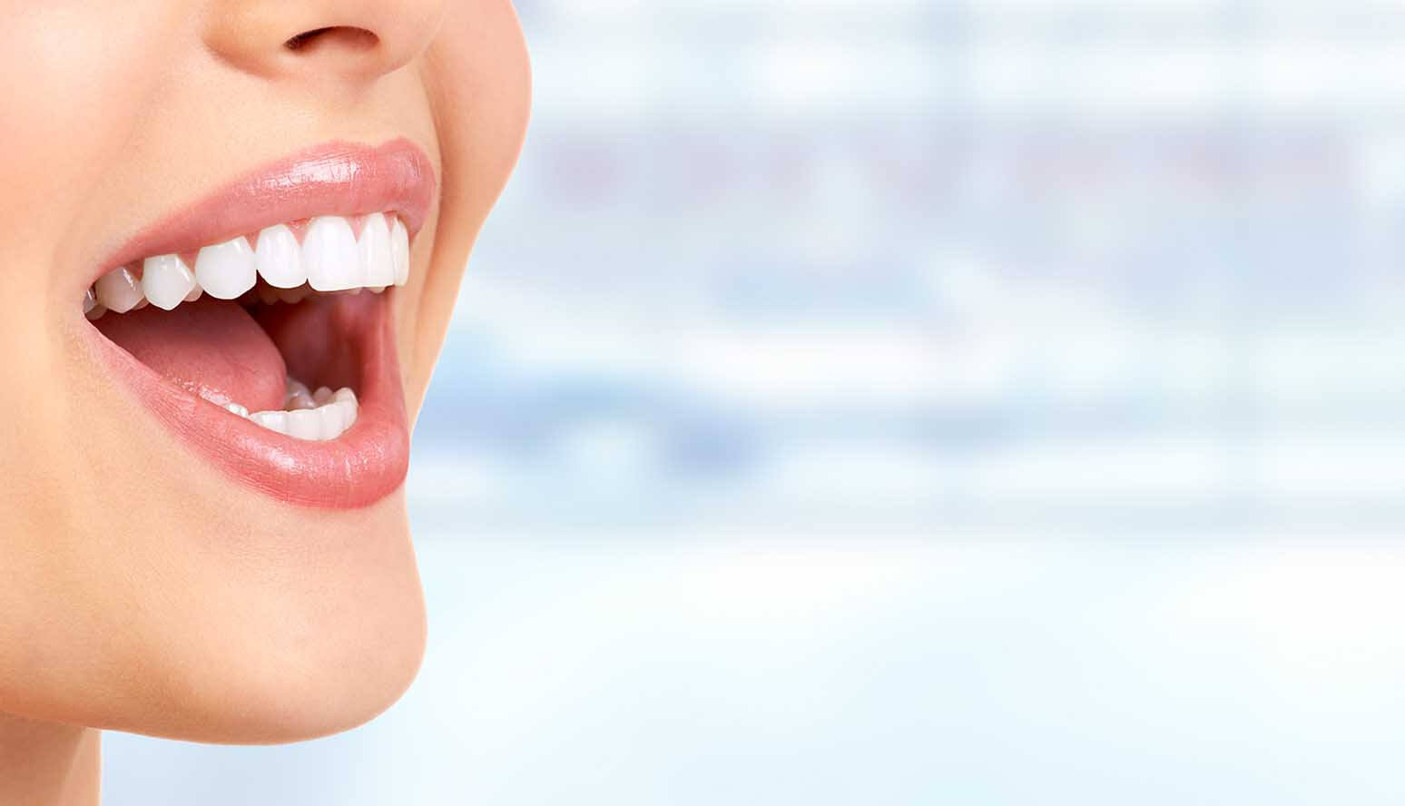 hollywoodsmile-ss