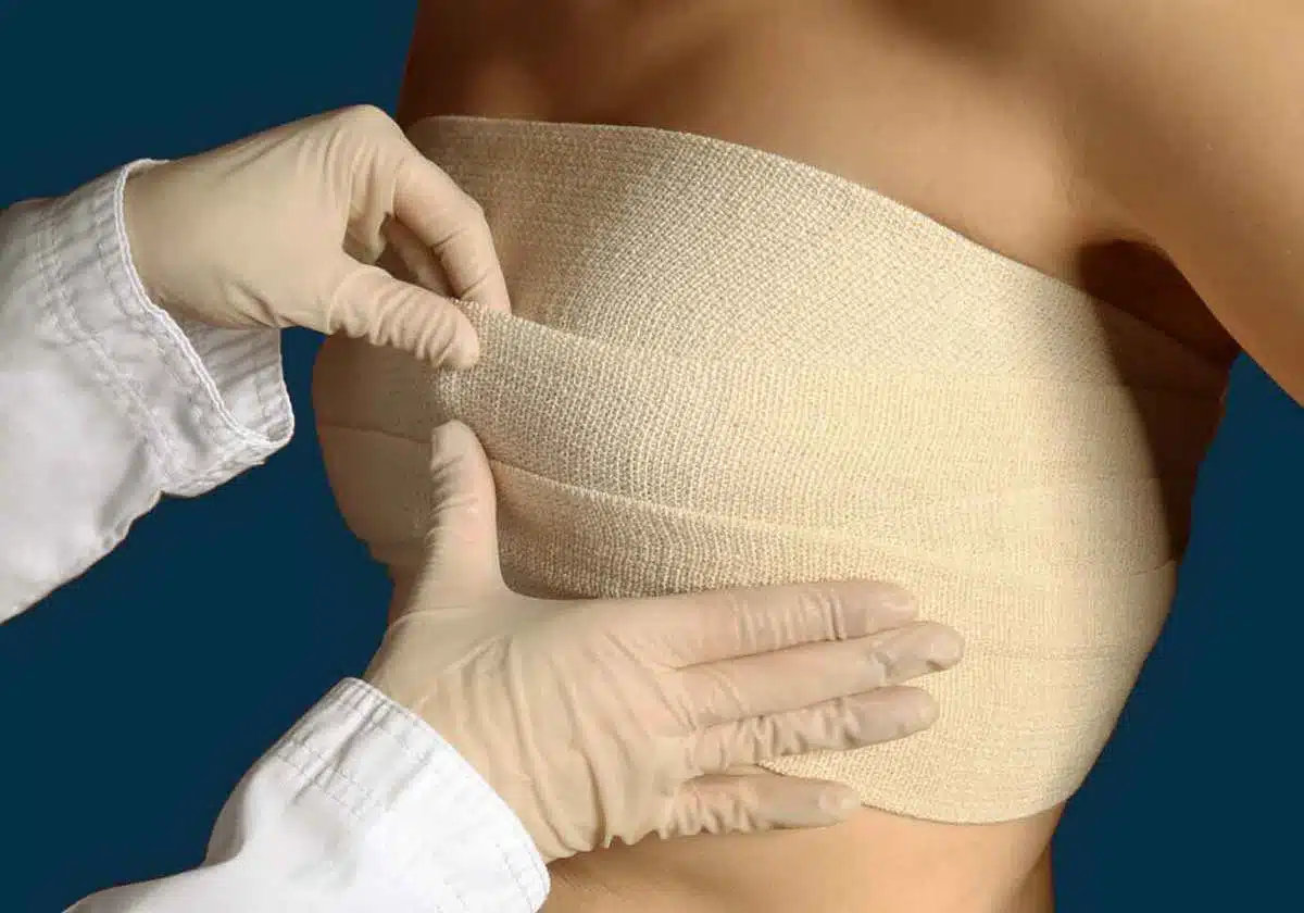 Breast Augmentation Recovery Timeline