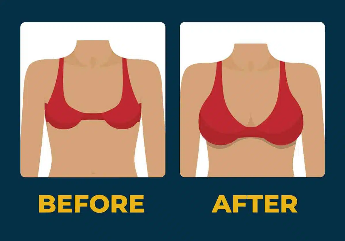 what-are-breast-augmentation-complications