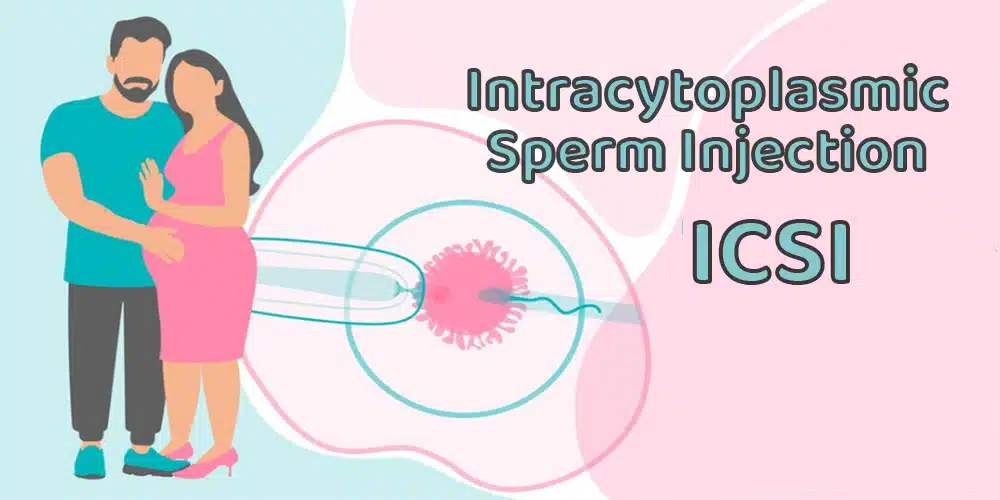 ICSI Intracytoplasmic sperm injection