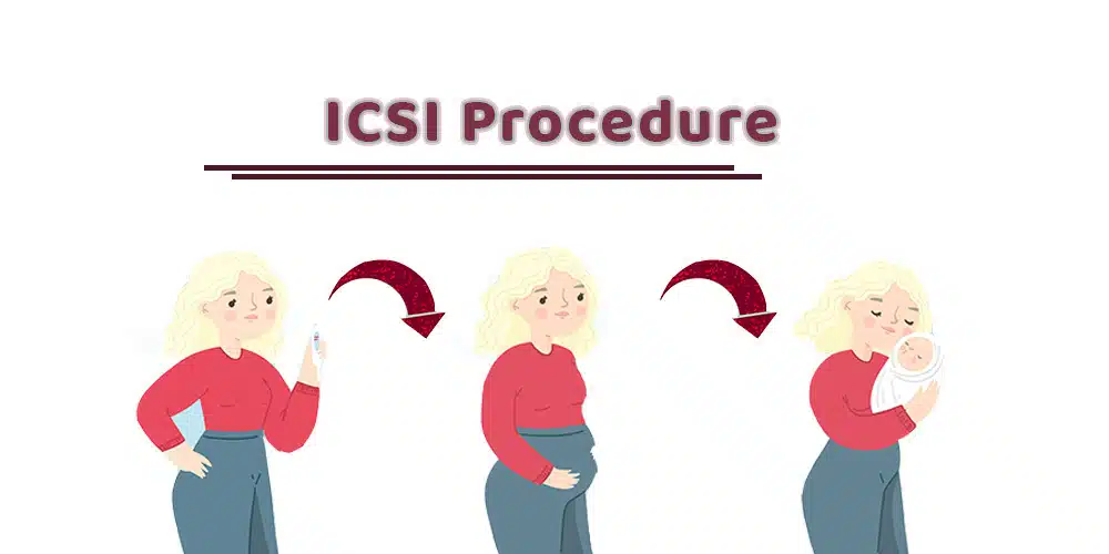icsi procedure