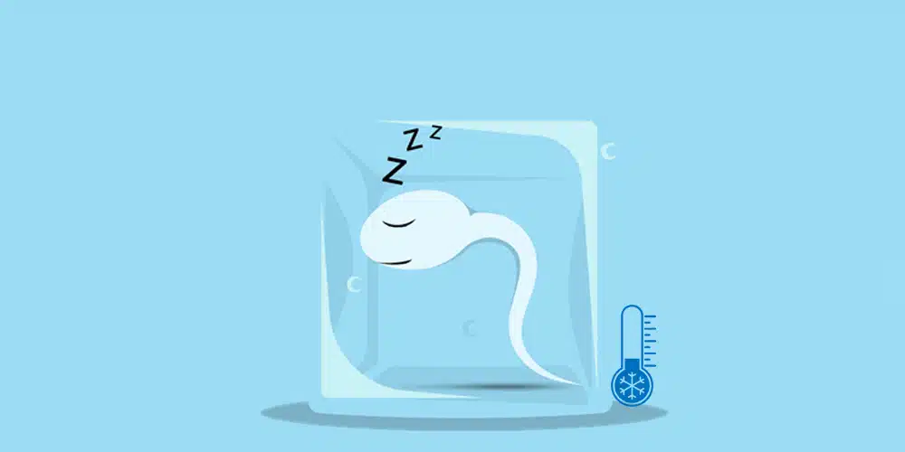 Sperm freezing in Iran